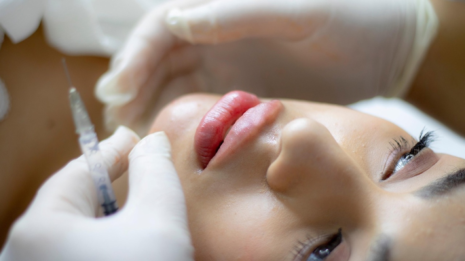 Trattamento filler viso, paziente distesa — medicina estetica Paidos
