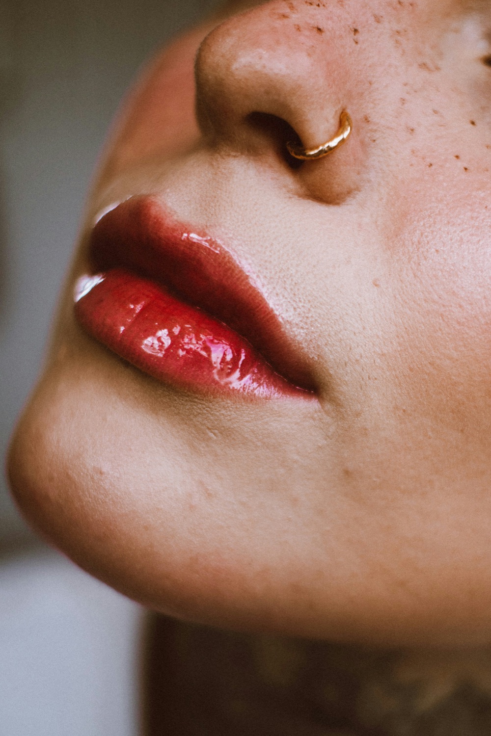 Labbra trattate con filler, primo piano — risultati medicina estetica Paidos